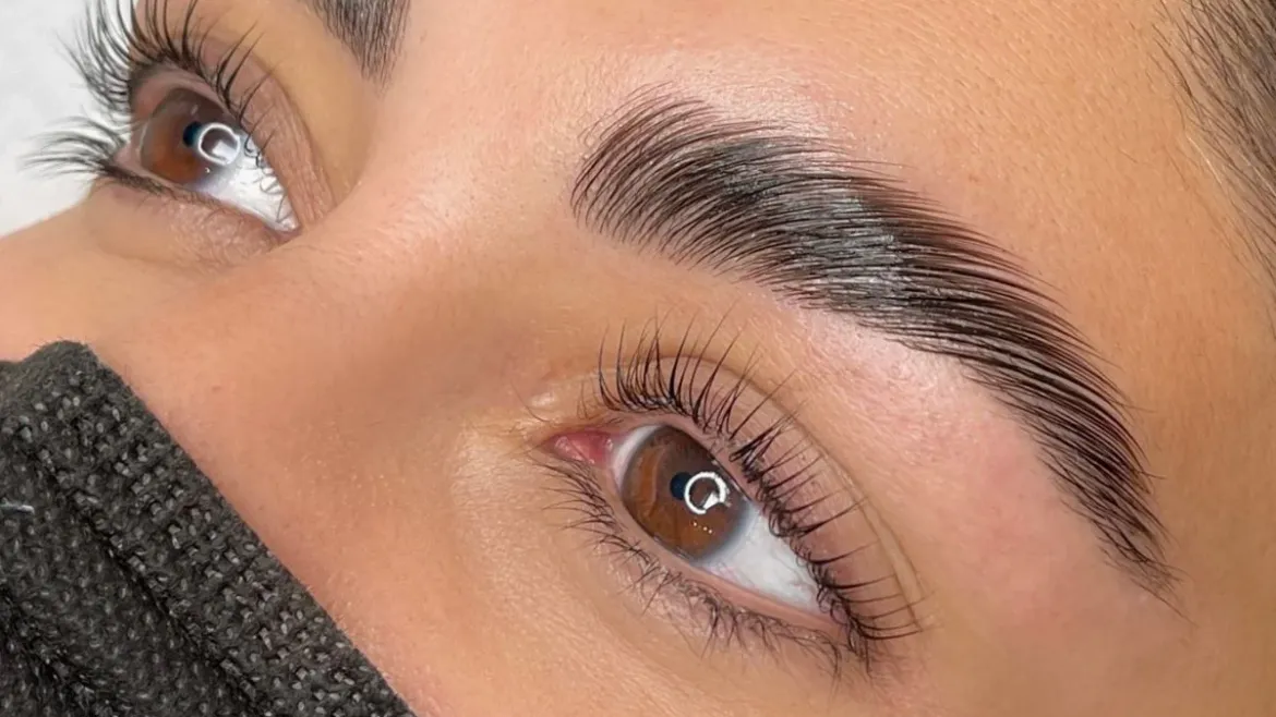 Brow lift